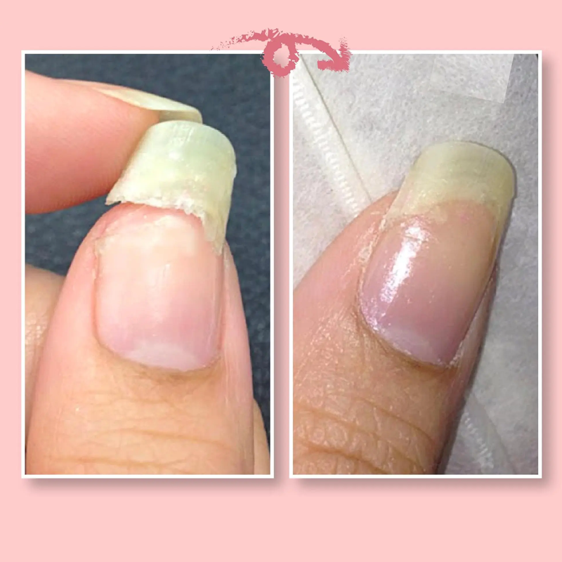 Nail Repaor Prptection Gel